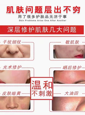 蓝铜肽冻干粉修复敏感肌角质层去红血丝激光点斑后红印美容院修护