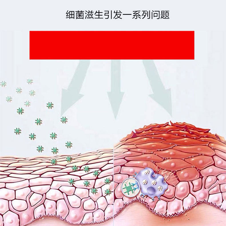 修正头皮毛囊炎型非药膏头部洗发水 信德堂大药房皮肤消毒护理（消）