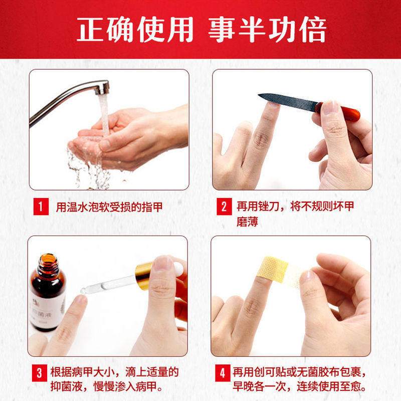 修正灰指甲专用盒抑菌液正品 信德堂大药房保健理疗