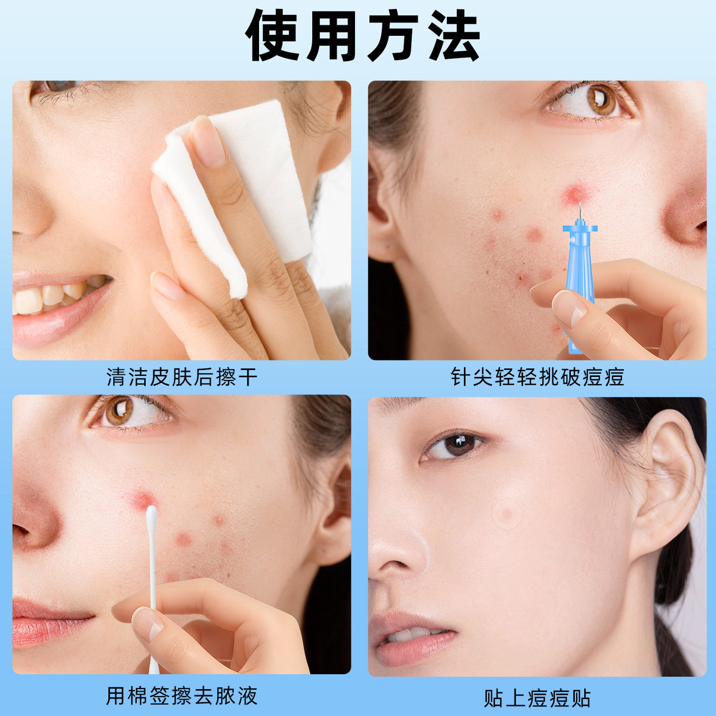 粉刺针闭口针一次性脂肪粒去除神器挤痘痘清痘祛痘针暗疮针清,淘宝优惠券,粉丝福利购,淘宝优惠卷