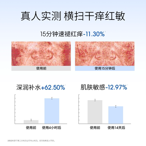 【秒杀专属】ddg511特护精华2.0清爽滋润版补水保湿舒缓 - 图1