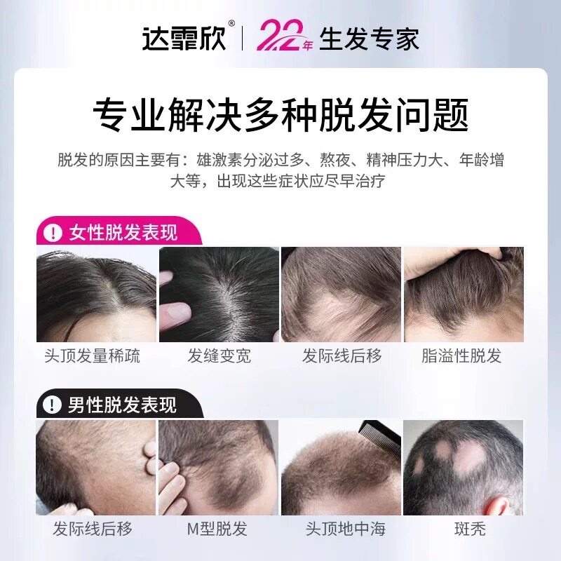 达霏欣官方旗舰米诺地尔生发液男女分治白发脱发掉发斑秃防脱发