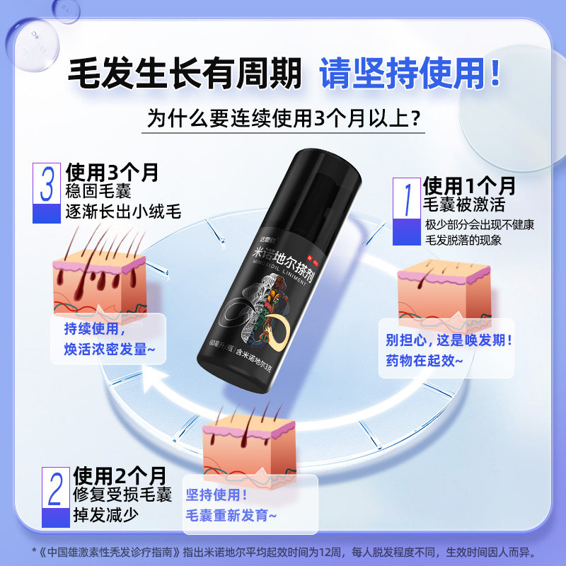  达霏欣白发脱发
