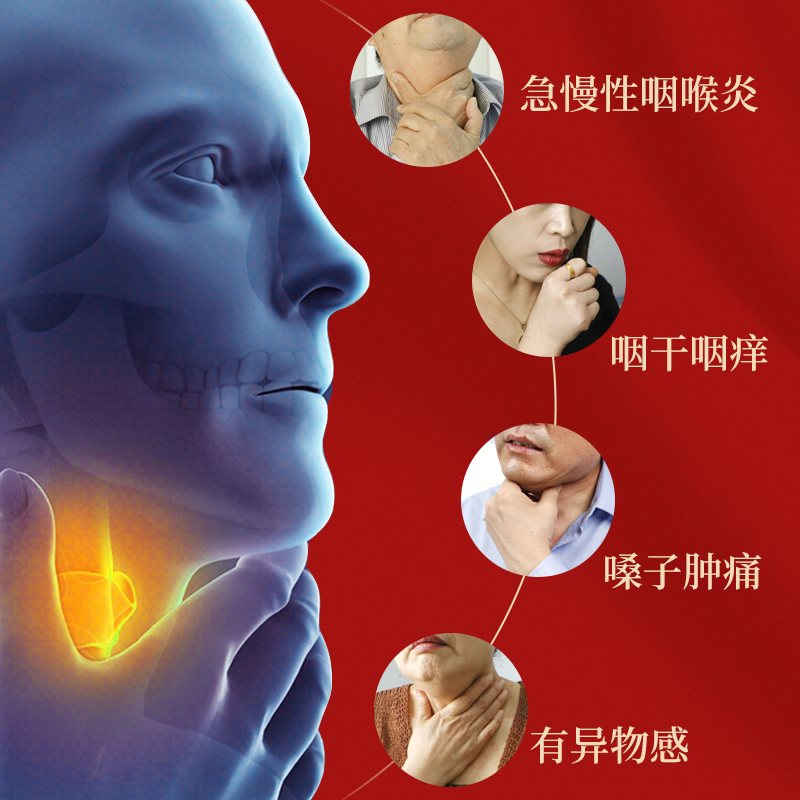 芙顺堂咽扁舒冷敷治疗凝胶急慢性咽喉炎凝胶扁炎软膏药贴官方正品 - 图2