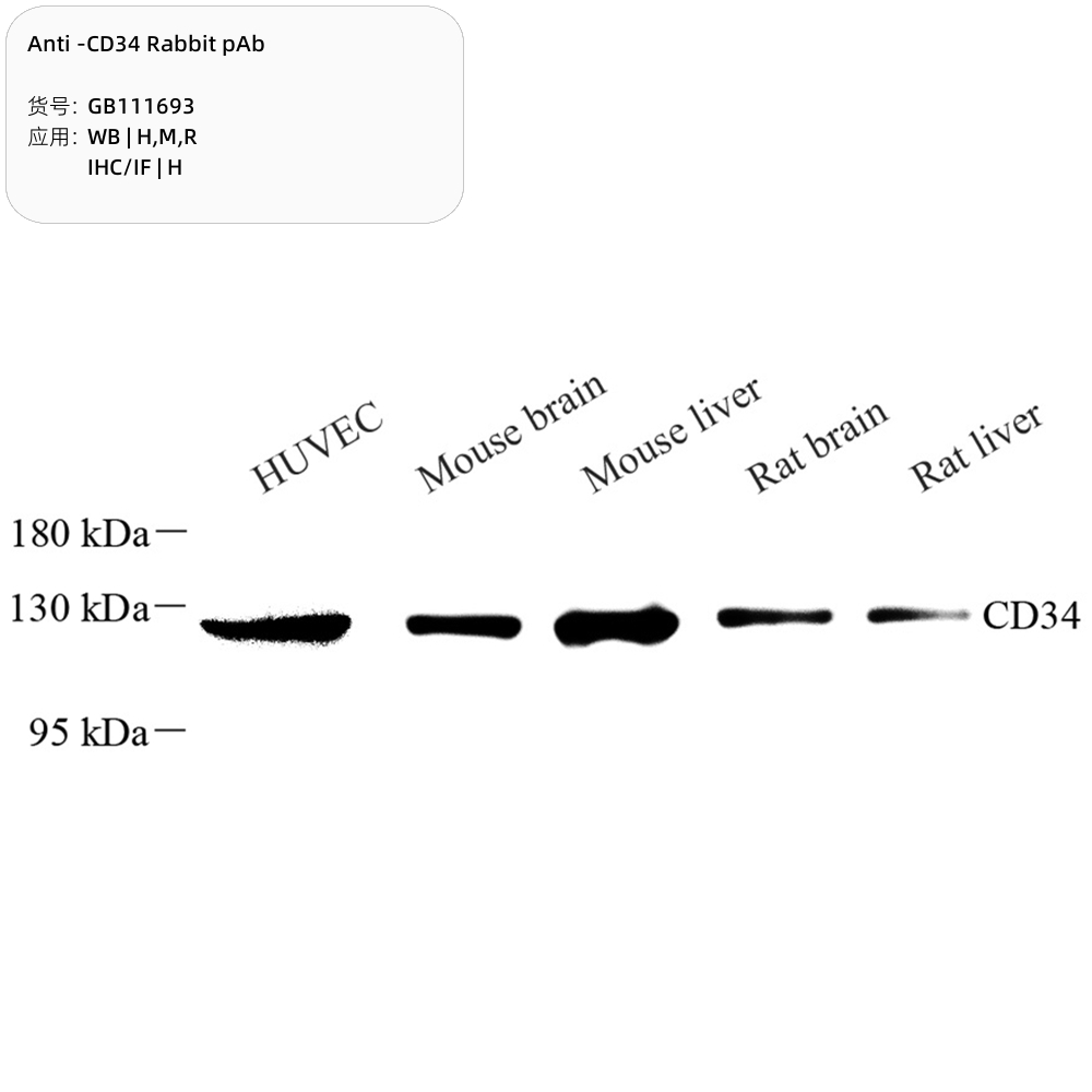 Servicebio抗-CD34兔pAb,Anti-CD34 Rabbit pAb,GB111693,100μL-图3