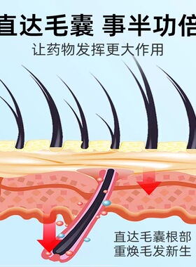 跨境头皮生发微针导入仪家用MTS中胚层无针免麻冻干粉浅导微晶