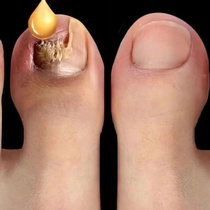 (Nanjing Tongrentang) is not covered with no quick elimination of bad potassium bad potassium kerb to help you get rid of your troubles