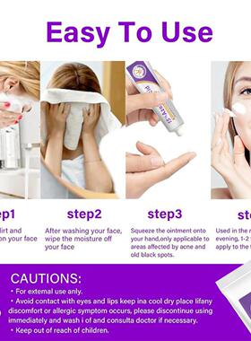 Azelaic Acid 15% gel salicylic acid acne removing cream