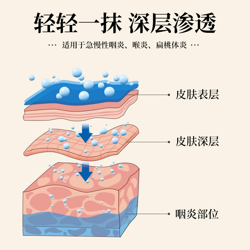 [芙顺堂]咽扁型咽喉冷敷咽炎凝膏 芙顺堂福建专卖口咽类修复品