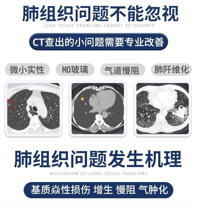 肺结节散结茶消除肺结节的药清肺片素中药清肺润肺养肺去肺磨玻璃 - 图0