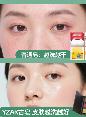 叙利亚大马士革精油皂无化学添加