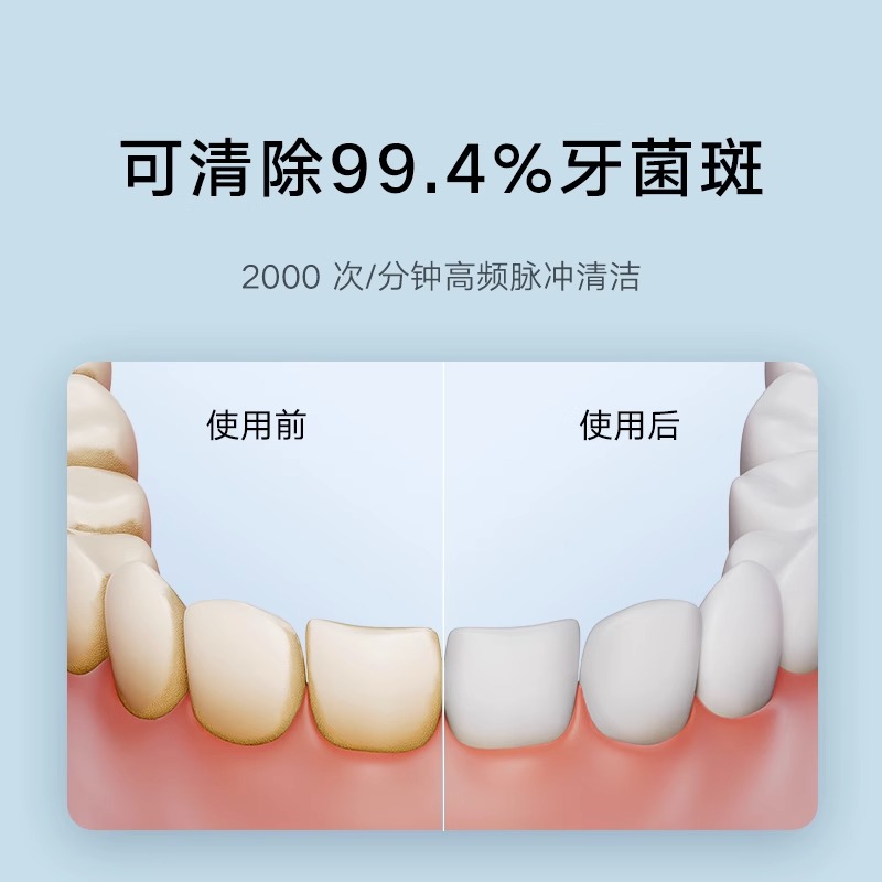 小米米家电动冲牙器F300家用便携式水牙线口腔洁牙齿牙缝洗牙器-图0