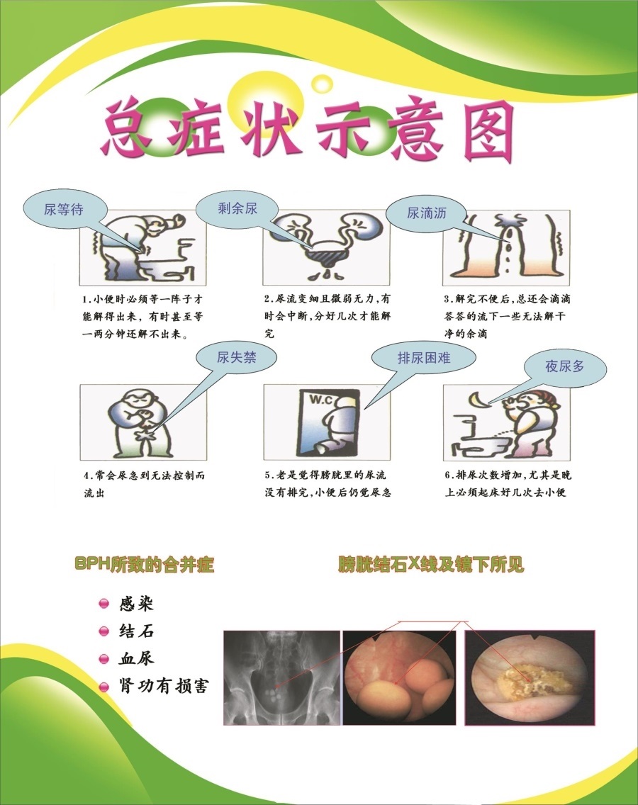 前列腺增生治疗拒绝等待海报展板前列腺肥大食疗前列腺保养墙贴