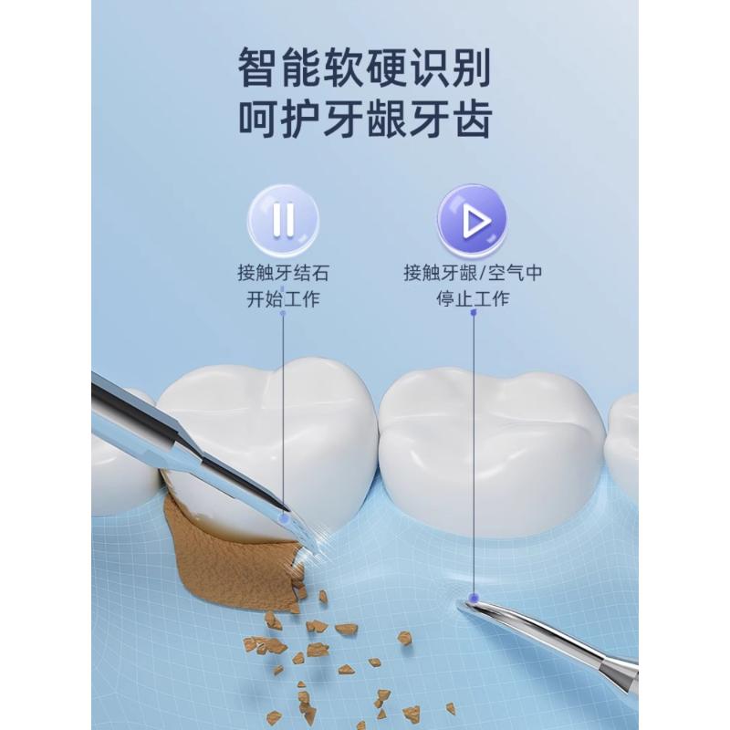 智选超声波洁牙器去除牙结石神器洗牙齿冲污垢家用仪除牙垢牙 - 图2