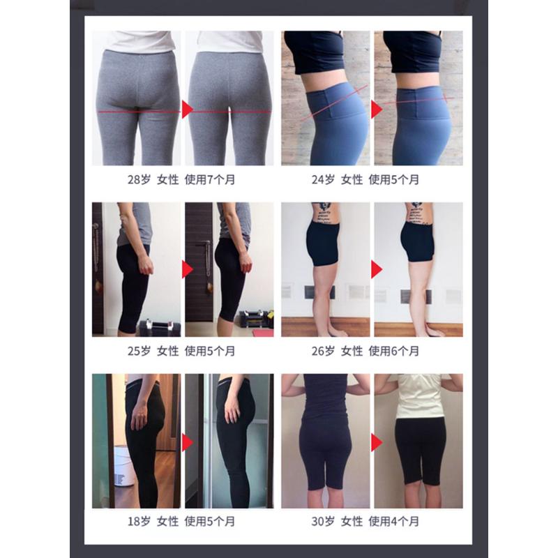 骨盆修复盆骨矫正器胯骨前倾家用仪器产后假胯宽垮带闭合收胯神器 - 图2