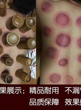 【抢购】单个超大号竹罐减肥拔火罐单罐竹火罐中医竹吸筒拔罐竹拔