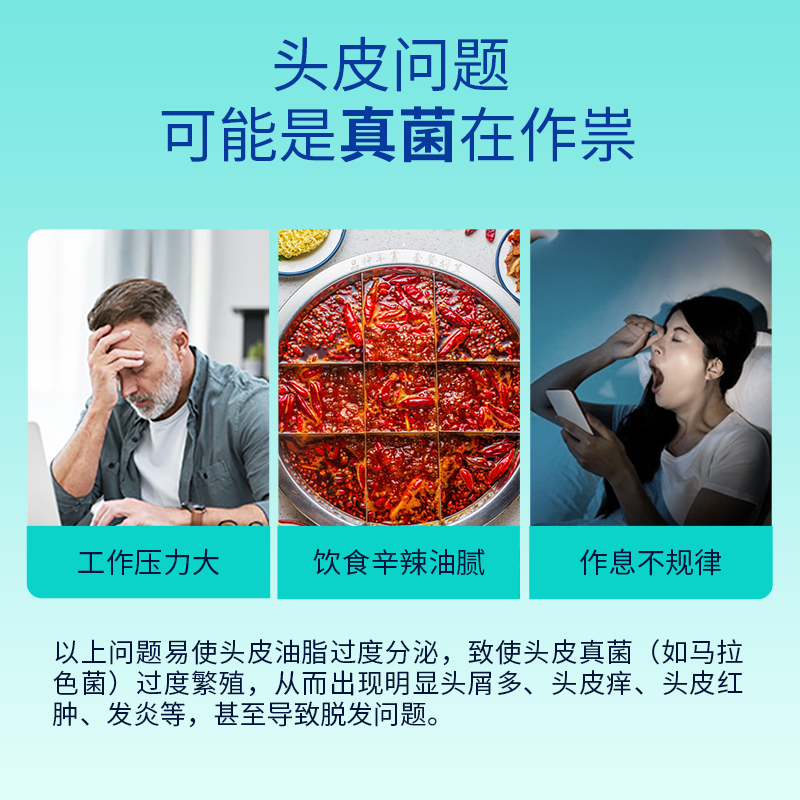 tedol葡萄牙酮康唑洗剂去屑止痒二硫化硒洗发水脂溢性皮炎120ml
