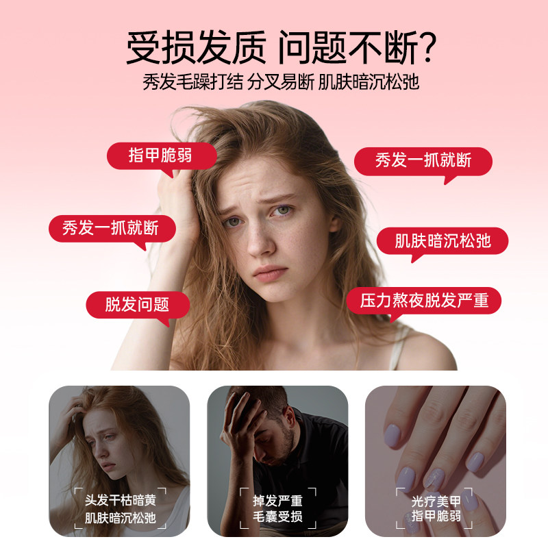 佩力丝小红丸Pilexil西班牙进口防脱锯叶棕维生素固发软安全胶囊