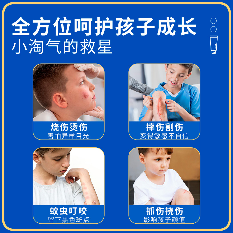 丝芙美瘢痕膏儿童专用小孩瘢痕膏官方旗舰店正品瘢痕硅酮非凝胶