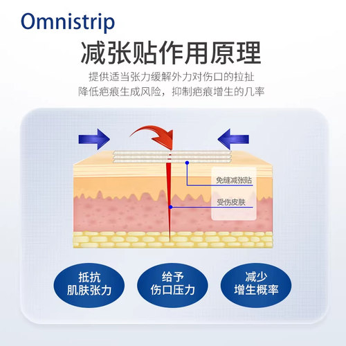 德免减张贴Omnistrip免缝胶带防止增生去疤痕贴愈合伤口免缝合器 - 图1