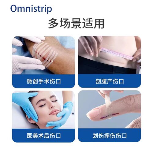 德免减张贴Omnistrip免缝胶带防止增生去疤痕贴愈合伤口免缝合器 - 图0