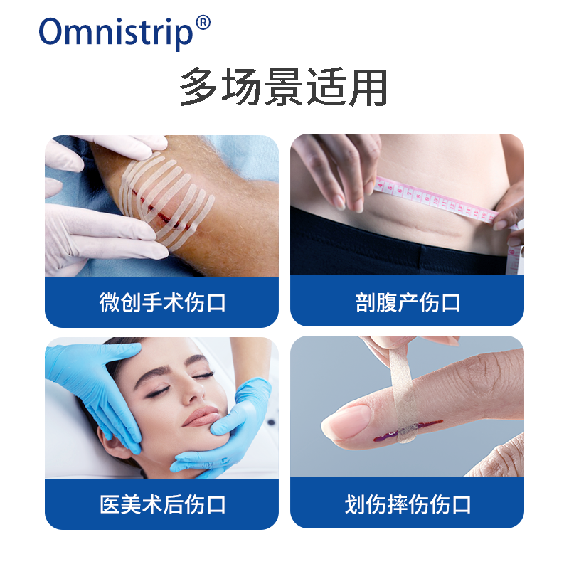 德免减张贴Omnistrip免缝胶带防止增生疤痕贴愈合伤口免缝合器-图0