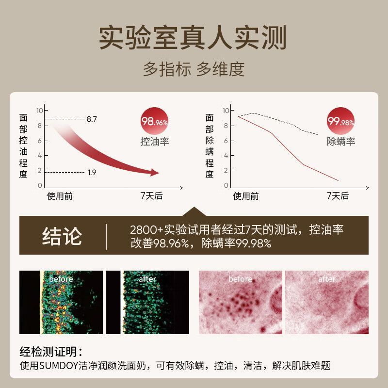 日本进口SUMDOY洗面奶除螨控油祛痘深层清洁细致毛孔男女士洗面奶 - 图1