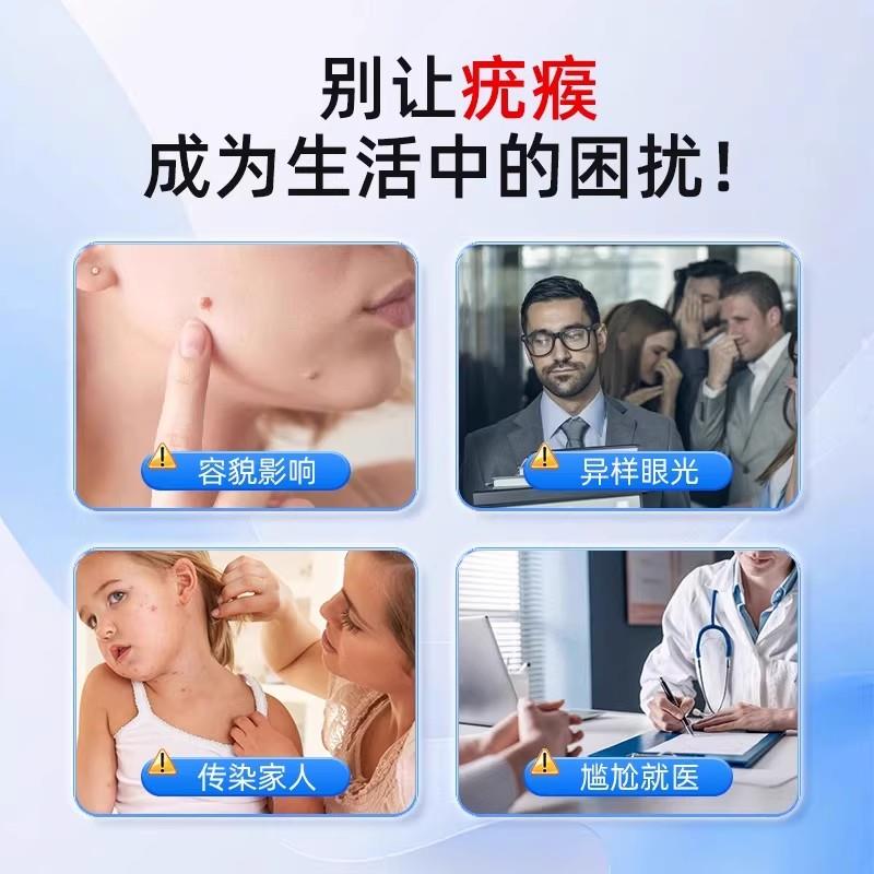 5%咪奎喹莫特乳膏正品丝状扁平尤跖尤专用百草克尤膏大药房旗舰店 - 图2