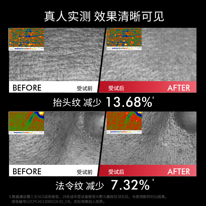 【ulike出品】jmoon极萌红光射频仪 Jmoon极萌电子美容仪