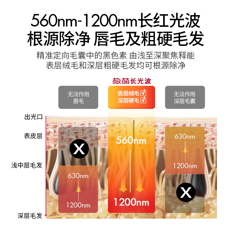 【ulike出品】jmoon极萌小羊蓝宝石 Jmoon极萌脱毛仪器