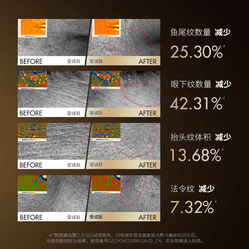  Jmoon极萌电子美容仪