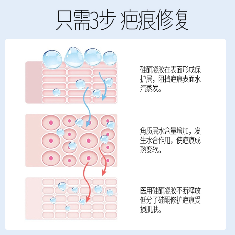 李护士祛疤膏修复去疤痕膏除疤儿童医用硅酮凝胶手术剖腹产烫伤 - 图0