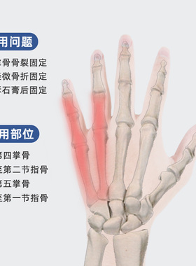 【顺丰加急】第四五掌骨骨折护具