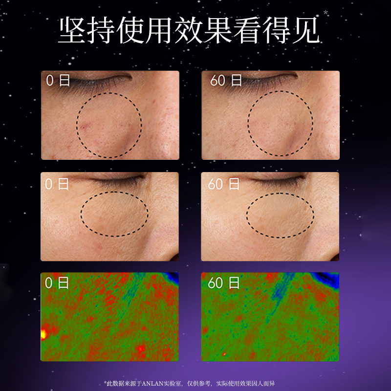 ANLAN安兰面罩美容仪家用脸部嫩红蓝光大排灯光子面膜仪器照光肤