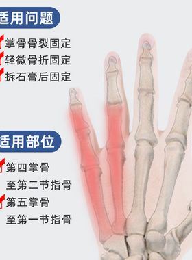 掌骨骨折术后恢复夹板手指固定器