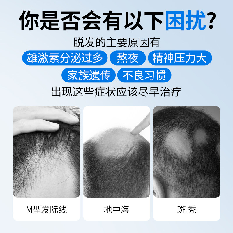 法国BAILLEUL巴约尔米诺地尔酊搽剂小白管生发液男女性密发防脱发,淘宝优惠券,粉丝福利购,淘宝优惠卷