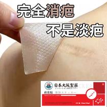 (Osaka Japan) Barring post repair Caesarean section-Hyperplasia _ Concave and convex Barmarks