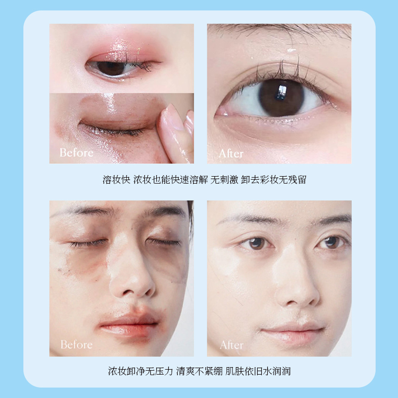 EKII溫和清潔眼唇潔膚油凈澈卸妝舒緩肌膚溫和不刺激A1_ekii旗艦店_美容護膚/美體/精油