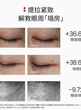 【淘秒】译龄30+眼霜5ml旅行装，赠20元正装回购券
