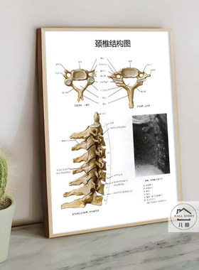 人体骨骼医学解剖图挂画脊柱四肢结构图骨科装饰画医生办公室壁画