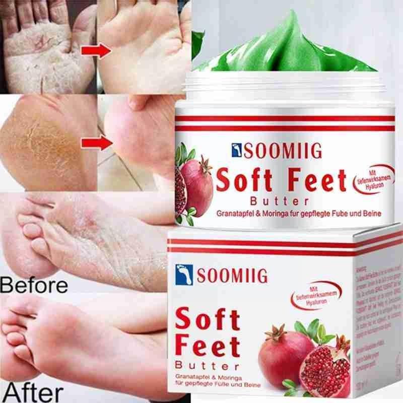 Foot Chapped Repair Cream Foot Frostbite Ointment Hand - 图0