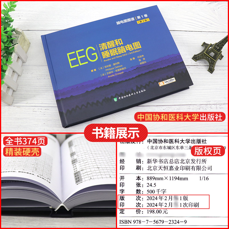 【正版包邮】清醒和睡眠脑电图 任连坤等译脑电图图谱卷正常清醒脑电图和少见的模式 共包括180幅脑电图 中国协和医科大学出版社