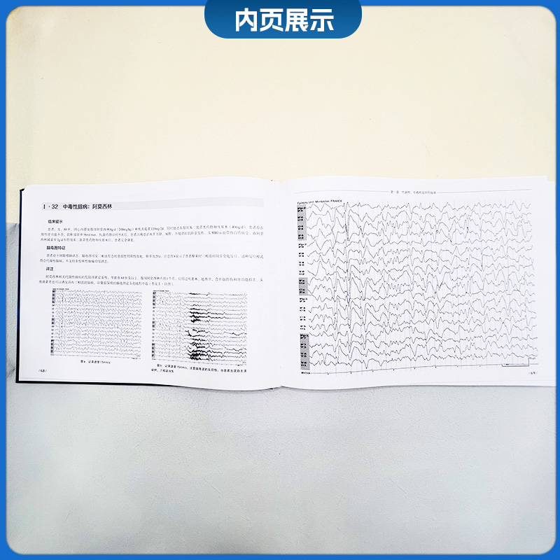 神经系统疾病和重症监护  脑电图图谱 第3卷 任连坤等主译 中国协和医科大学出版社 9787567923874