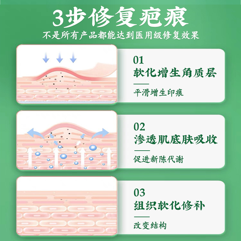 祛疤膏儿童疤痕修复除疤膏疤克去疤医用硅酮凝胶烫伤手术小孩专用