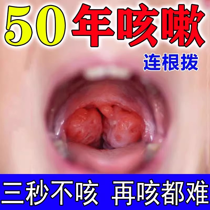 【50倍止咳润肺】止咳贴特效咳嗽清肺化痰神器小儿成人平喘润肺JY - 图0