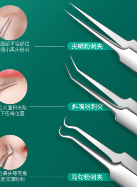 挑痘痘工具暗疮针去黑头粉刺针