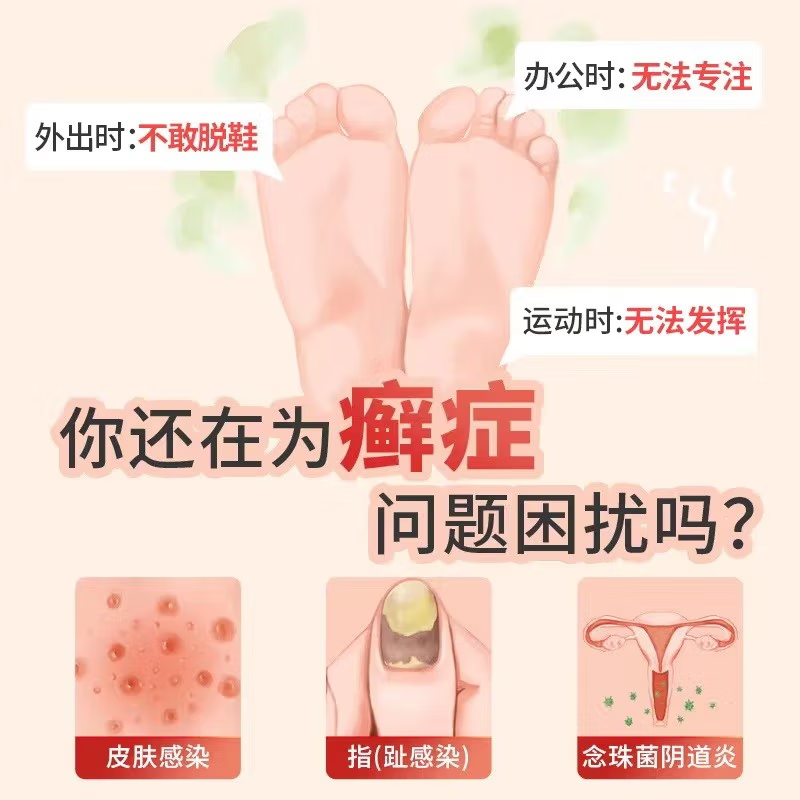  今医师大药房癣症