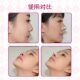 Adjustable cutting nose patch to reduce the size of the nose