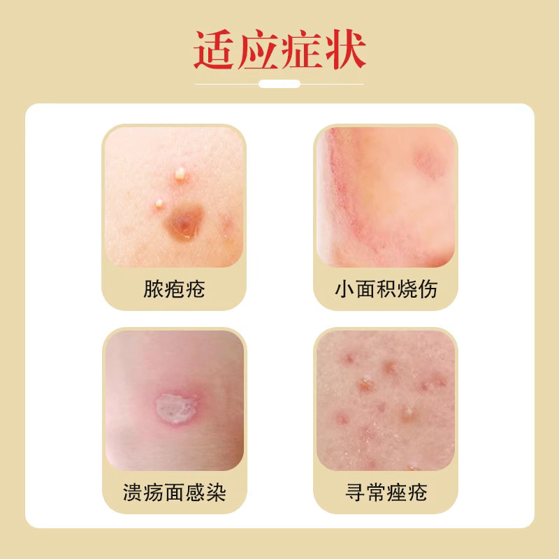 白云山红霉素软膏药10g 外用抗菌消炎皮肤病乳膏罗官方旗舰店正品,淘宝优惠券,粉丝福利购,淘宝优惠卷