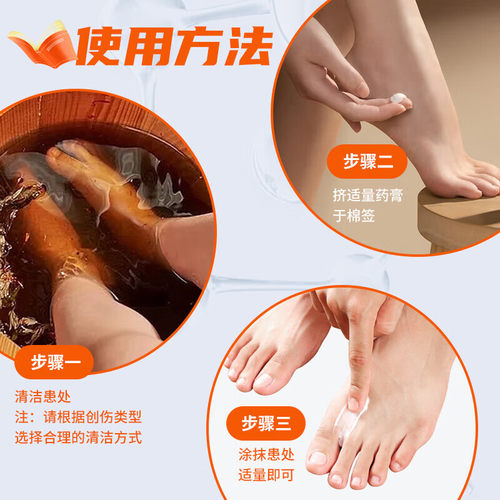 太平 硝酸咪康唑乳膏手真菌感染手足癣头癣体股癣手上起小水泡等 - 图3